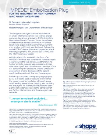 LIT1100 Rev A – Case Study – IMPEDE R Common Iliac – Morgan