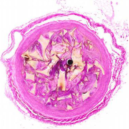 Magnified histology image