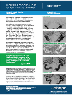 Neurovascular embolization case study