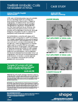 Neurovascular embolization case study