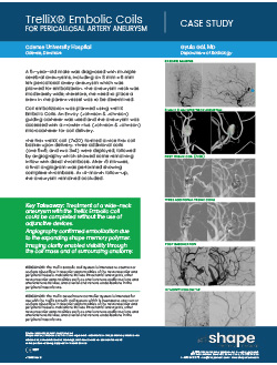 Neurovascular embolization case study