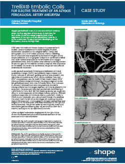 Neurovascular embolization case study