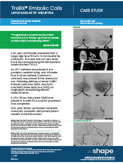 Neurovascular embolization case study