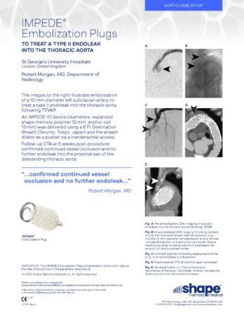 LIT1101 Rev A – Case Study – IMPEDE Type II EL Toracic aorta – Morgan