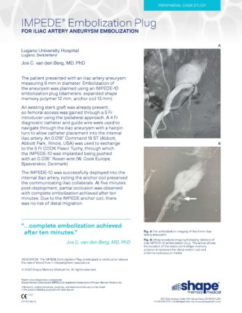 LIT1103 Rev A – Case Study – IMPEDE – Iliac Artery Embo – van den Berg