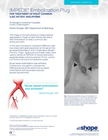 LIT1104 Rev A – Case Study – IMPEDE Iliac Artery Aneurysm 2 – Morgan