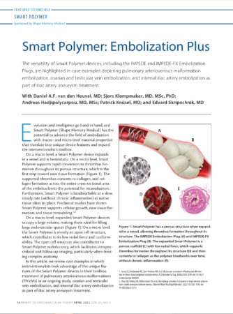 Embolization Plus